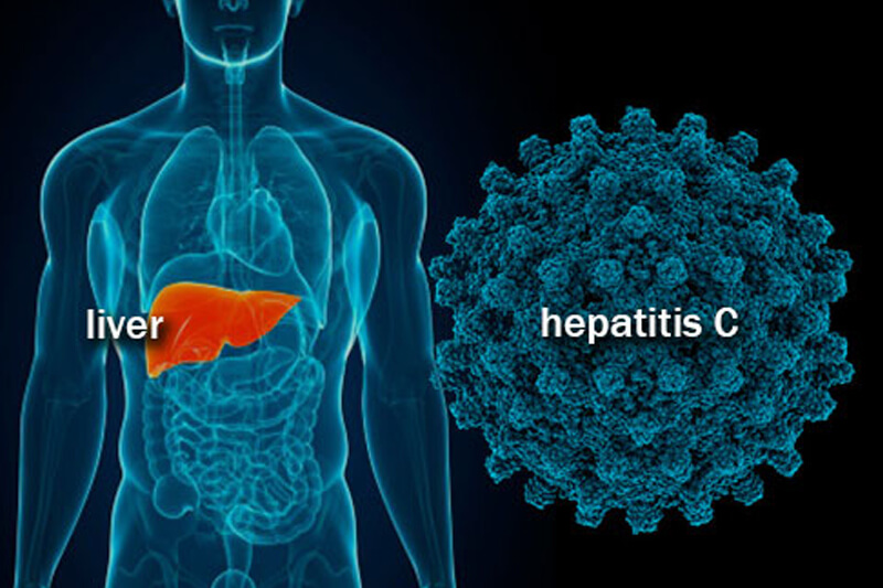 Hepatitis-C (1)