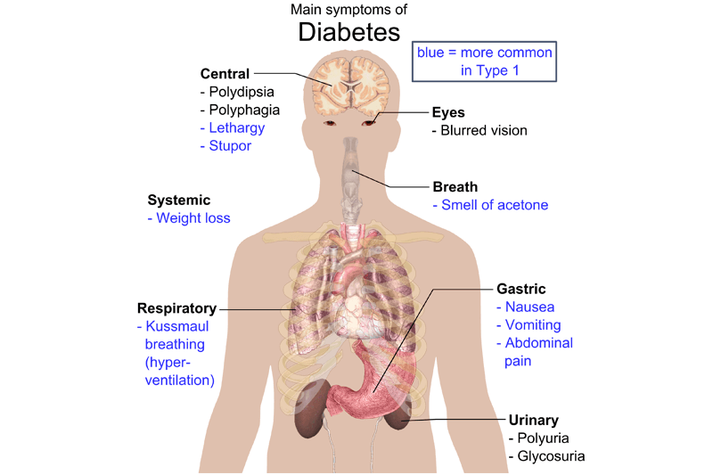 Main_symptoms_of_diabetes (1)