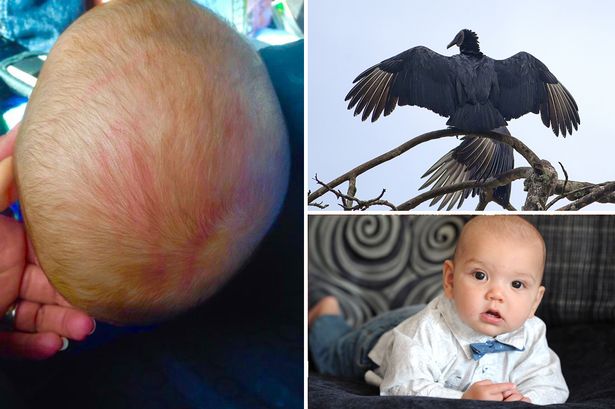 american-vulture-attacked-a-baby-in-safari-park