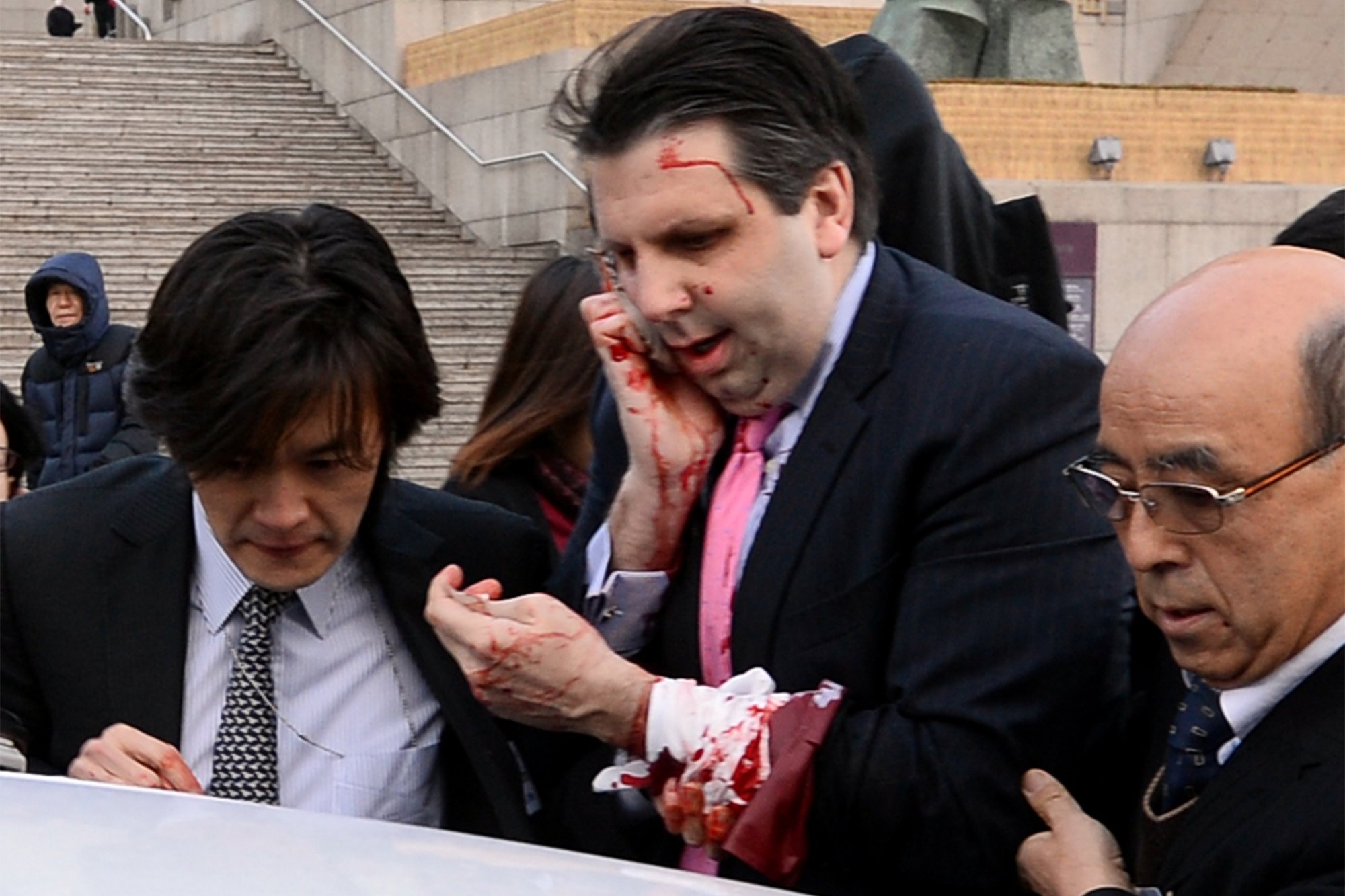 us-ambassador-to-south-korea-injured-by-a-knife-attack