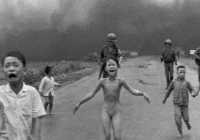 laser-treatment-for-the-living-symbol-of-vietnam-napalm-attack