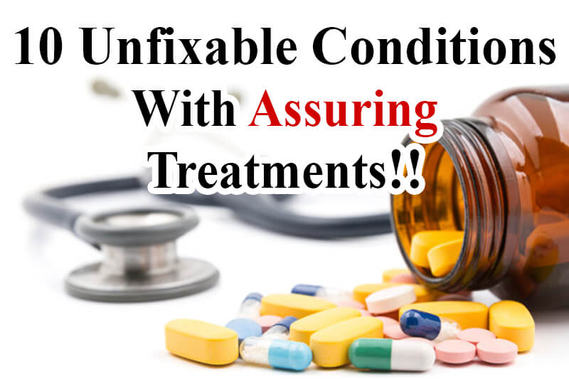 10-unfixable-conditions-with-assuring-treatments