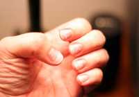heres-why-you-see-white-spots-on-your-nails