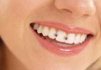 reverse-cavities-the-natural-way